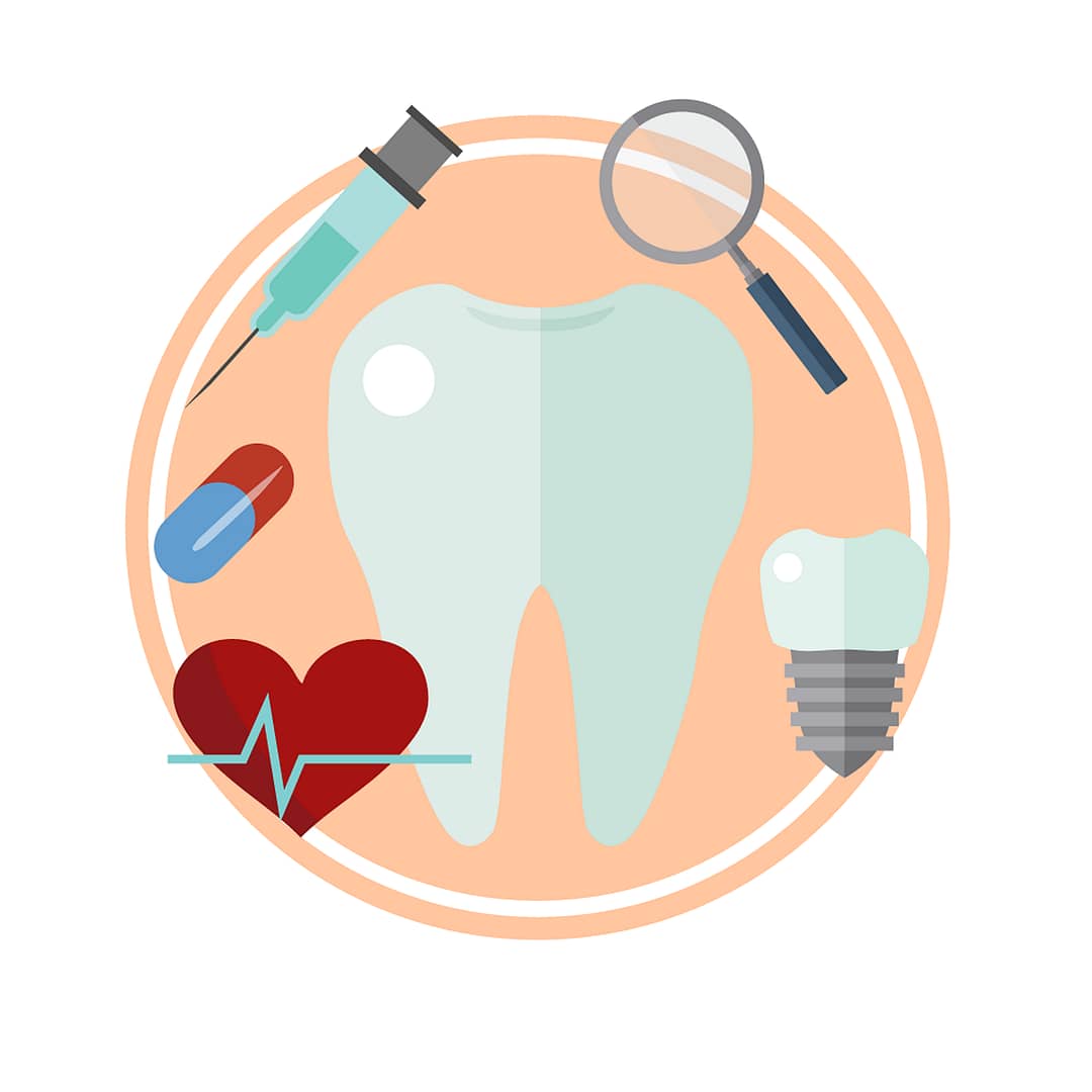 Considerations Before Getting Dental Implants
