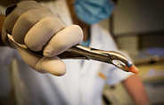 tooth extraction