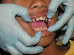 dental