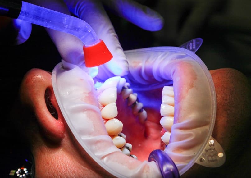 Factors to Consider When Hiring a Dentist